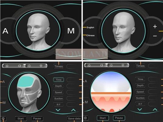 Mesin Penghilang Rambut Laser Dioda Laser Semikonduktor 808nm Dengan Sensor Kontak Kulit Memastikan Perawatan Penghilangan Rambut Cepat