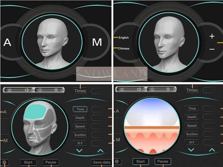 Mesin Penghilang Rambut Laser Dioda Laser Semikonduktor 808nm Dengan Sensor Kontak Kulit Memastikan Perawatan Penghilangan Rambut Cepat